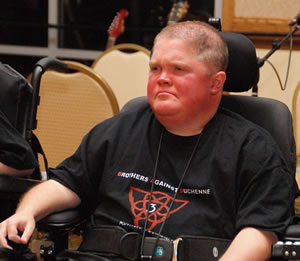 Duchenne’s muscular dystrophy (DMD) is an inherited muscle wasting disease characterized by progressive muscle weakness.